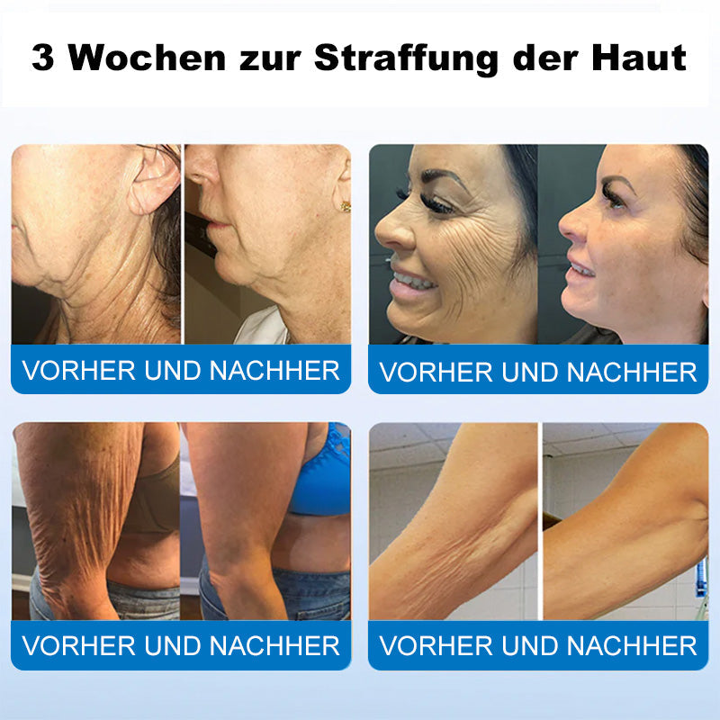 👩⚕️💖Furzero® Skin Firming Cream with Oligopeptide Complex