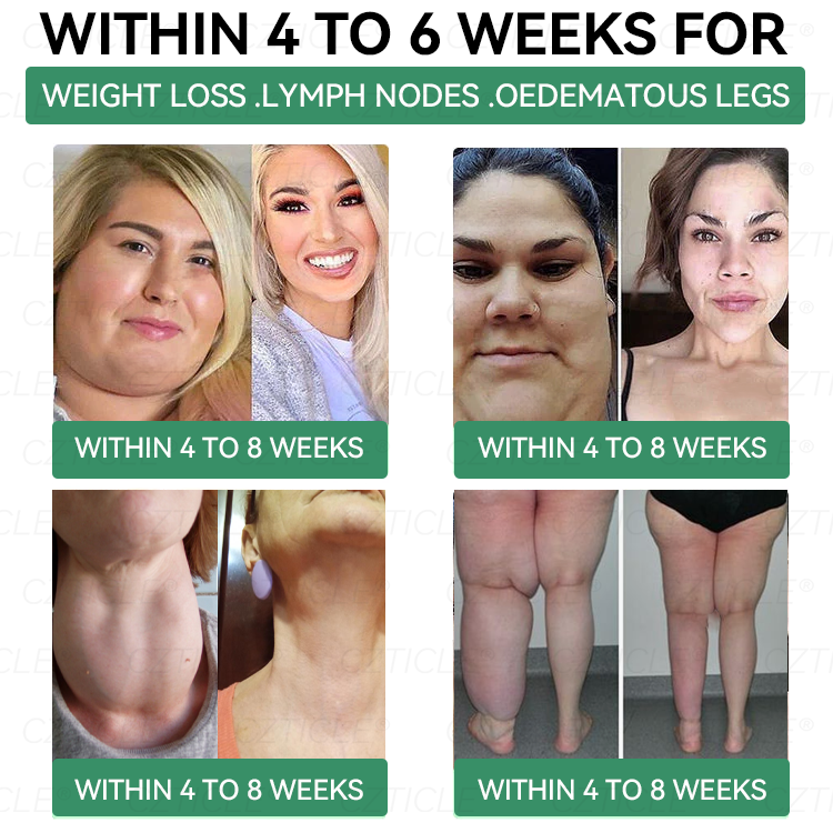 [𝑂𝑓𝑓𝑖𝑐𝑖𝑎𝑙 𝑆𝑡𝑜𝑟𝑒] ZVOEVO® 𝐺𝐿𝑃-1  𝑆𝑙𝑖𝑚𝑚𝑖𝑛𝑔 & 𝐻𝑒𝑎𝑙𝑡ℎ 𝑁𝑎𝑠𝑎𝑙 𝑅𝑖𝑛𝑔 ｜⏳ 𝐹𝑎𝑠𝑡 𝐹𝑎𝑡 𝐵𝑢𝑟𝑛 & 𝑀𝑒𝑡𝑎𝑏𝑜𝑙𝑖𝑐 𝐵𝑎𝑙𝑎𝑛𝑐𝑒