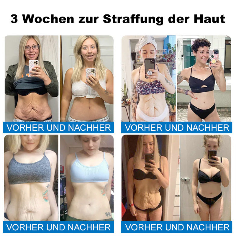 👩‍⚕️💖Furzero® Skin Firming Cream with Oligopeptide Complex