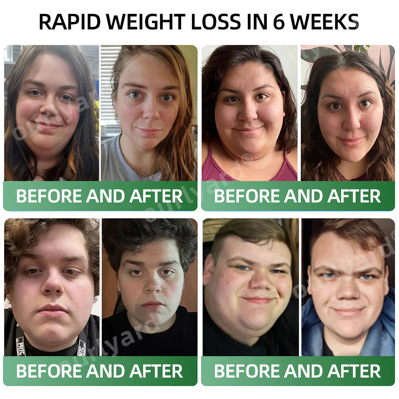 💕👩‍⚕️Ourlyard® Meglutide Diet Drops - Made & Shipped From United Kingdom👩‍⚕️