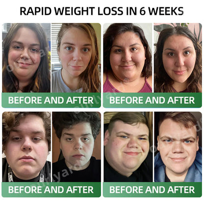 💕👩‍⚕️Ourlyard® Meglutide Diet Drops - Made & Shipped From United Kingdom👩‍⚕️