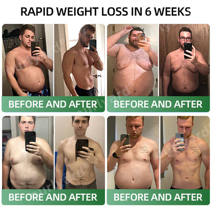 💕👩‍⚕️Ourlyard® Meglutide Diet Drops - Made & Shipped From United Kingdom👩‍⚕️